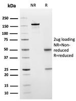 SERBP1/PAI-RBP1 Antibody in SDS-PAGE (SDS-PAGE)