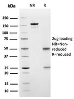 SERBP1/PAI-RBP1 Antibody in SDS-PAGE (SDS-PAGE)