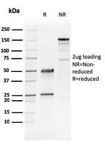 GATA-3 (Breast and Urothelial Marker) Antibody in SDS-PAGE (SDS-PAGE)