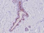 GATA-3 (Center) (Breast and Urothelial Marker) Antibody in Immunohistochemistry (Paraffin) (IHC (P))