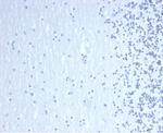 GATA-3 (Center) (Breast and Urothelial Marker) Antibody in Immunohistochemistry (Paraffin) (IHC (P))