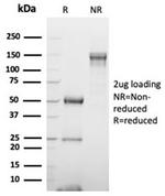 GATA-3 (Center) (Breast and Urothelial Marker) Antibody in SDS-PAGE (SDS-PAGE)