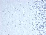 GATA-3 (Center) (Breast and Urothelial Marker) Antibody in Immunohistochemistry (Paraffin) (IHC (P))