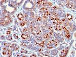 GATA-3 (Breast and Urothelial Marker) Antibody in Immunohistochemistry (Paraffin) (IHC (P))