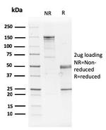 GATA-3 (Breast and Urothelial Marker) Antibody in SDS-PAGE (SDS-PAGE)