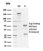 GATA-3 (Breast and Urothelial Marker) Antibody in SDS-PAGE (SDS-PAGE)