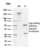 GATA-3 (Breast and Urothelial Marker) Antibody in SDS-PAGE (SDS-PAGE)