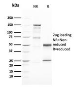 GATA-3 (Breast and Urothelial Marker) Antibody in SDS-PAGE (SDS-PAGE)