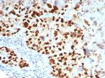 GATA-3 (Breast and Urothelial Marker) Antibody in Immunohistochemistry (Paraffin) (IHC (P))