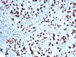 GATA-3 (Breast and Urothelial Marker) Antibody in Immunohistochemistry (Paraffin) (IHC (P))