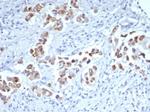 GATA-3 (Breast and Urothelial Marker) Antibody in Immunohistochemistry (Paraffin) (IHC (P))