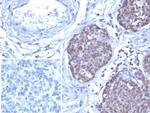 GATA-3 (Breast and Urothelial Marker) Antibody in Immunohistochemistry (Paraffin) (IHC (P))