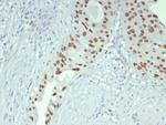 GATA-3 (Breast and Urothelial Marker) Antibody in Immunohistochemistry (Paraffin) (IHC (P))