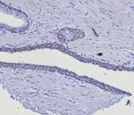 GATA-3 (Breast and Urothelial Marker) Antibody in Immunohistochemistry (Paraffin) (IHC (P))