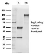 GC Vitamin D Binding Protein Antibody in Immunoelectrophoresis (IE)