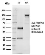 GC Vitamin D Binding Protein Antibody in SDS-PAGE (SDS-PAGE)