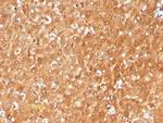 GCHFR Antibody in Immunohistochemistry (Paraffin) (IHC (P))