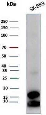 GCHFR Antibody in Western Blot (WB)