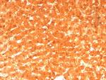 GCHFR Antibody in Immunohistochemistry (Paraffin) (IHC (P))