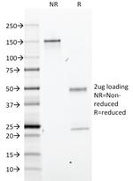 GFAP (Astrocyte and Neural Stem Cell Marker) Antibody in SDS-PAGE (SDS-PAGE)