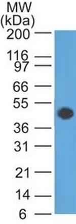 GFAP (Astrocyte and Neural Stem Cell Marker) Antibody in Western Blot (WB)