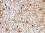 GFAP (Astrocyte and Neural Stem Cell Marker) Antibody in Immunohistochemistry (Paraffin) (IHC (P))