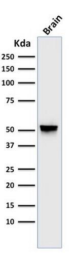 GFAP (Astrocyte and Neural Stem Cell Marker) Antibody in Western Blot (WB)