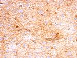 GFAP (Astrocyte and Neural Stem Cell Marker) Antibody in Immunohistochemistry (Paraffin) (IHC (P))