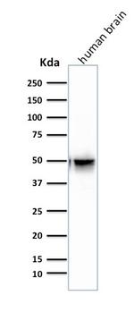 GFAP (Astrocyte and Neural Stem Cell Marker) Antibody in Western Blot (WB)