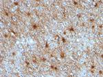 GFAP (Astrocyte and Neural Stem Cell Marker) Antibody in Immunohistochemistry (Paraffin) (IHC (P))