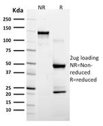 GFAP (Astrocyte and Neural Stem Cell Marker) Antibody in SDS-PAGE (SDS-PAGE)