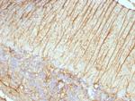 GFAP (Astrocyte and Neural Stem Cell Marker) Antibody in Immunohistochemistry (Paraffin) (IHC (P))