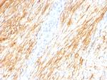 GFAP (Astrocyte and Neural Stem Cell Marker) Antibody in Immunohistochemistry (Paraffin) (IHC (P))