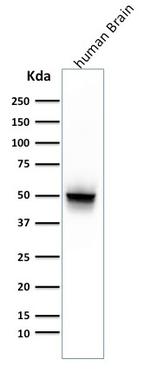 GFAP (Astrocyte and Neural Stem Cell Marker) Antibody in Western Blot (WB)