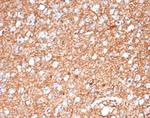 GFAP (Astrocyte and Neural Stem Cell Marker) Antibody in Immunohistochemistry (Paraffin) (IHC (P))