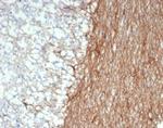 GFAP (Astrocyte and Neural Stem Cell Marker) Antibody in Immunohistochemistry (Paraffin) (IHC (P))