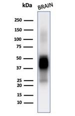 GFAP (Astrocyte and Neural Stem Cell Marker) Antibody in Western Blot (WB)