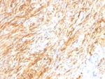 GFAP (Astrocyte and Neural Stem Cell Marker) Antibody in Immunohistochemistry (Paraffin) (IHC (P))