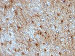 GFAP (Astrocyte and Neural Stem Cell Marker) Antibody in Immunohistochemistry (Paraffin) (IHC (P))