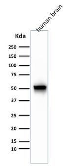 GFAP (Astrocyte and Neural Stem Cell Marker) Antibody in Western Blot (WB)