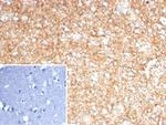 GFAP (Astrocyte and Neural Stem Cell Marker) Antibody in Immunohistochemistry (Paraffin) (IHC (P))