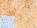 GFAP (Astrocyte and Neural Stem Cell Marker) Antibody in Immunohistochemistry (Paraffin) (IHC (P))