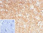 GFAP (Astrocyte and Neural Stem Cell Marker) Antibody in Immunohistochemistry (Paraffin) (IHC (P))