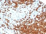 Anti Mullerian Hormone (AMH)/Mullerian Inhibiting Substance (MIS) Antibody in Immunohistochemistry (Paraffin) (IHC (P))