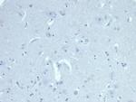 Anti Mullerian Hormone (AMH)/Mullerian Inhibiting Substance (MIS) Antibody in Immunohistochemistry (Paraffin) (IHC (P))