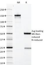 Growth Hormone Antibody in SDS-PAGE (SDS-PAGE)