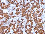 Growth Hormone Antibody in Immunohistochemistry (Paraffin) (IHC (P))