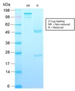 Growth Hormone (Pituitary Marker) Antibody in SDS-PAGE (SDS-PAGE)