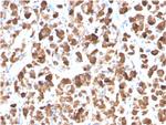 Growth Hormone (Pituitary Marker) Antibody in Immunohistochemistry (Paraffin) (IHC (P))