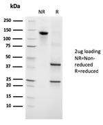 Growth Hormone (Pituitary Marker) Antibody in SDS-PAGE (SDS-PAGE)